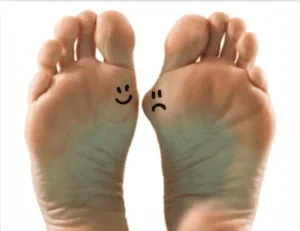 Bunion Treatments