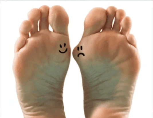 Bunion Treatments