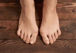 Understanding Bunions: When Foot Pain Becomes More Than Just a Bump