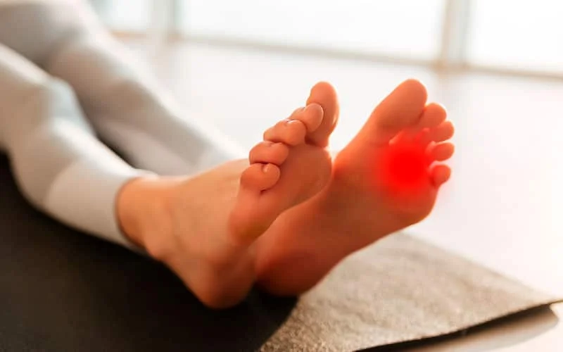 neuroma pain