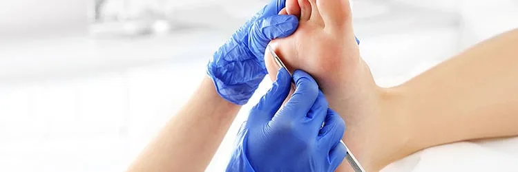 Paring of callus