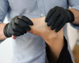 Minimally Invasive Bunion Surgery in Bridgewater, NJ