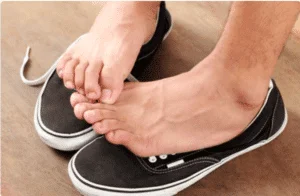 Person suffering from Athlete's Foot and Foot Fungus