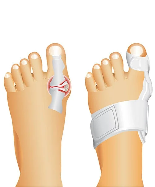 Toe/foot shield